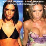 Victoria Beckham, before and after