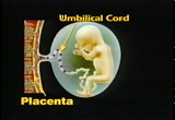 umbilical-cord-placenta